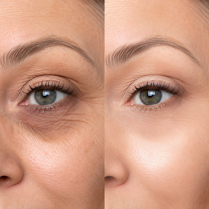 2-in-1 Air Cushion Concealer Pen – Instant Under-Eye Brightening & Flawless Spot Coverage