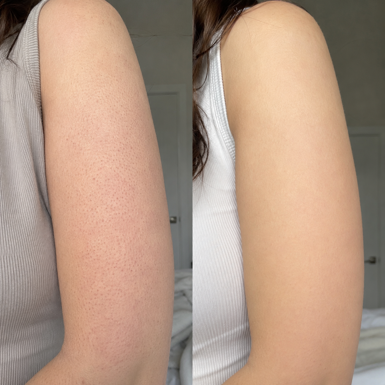Upper arm texture before and after exfoliating care