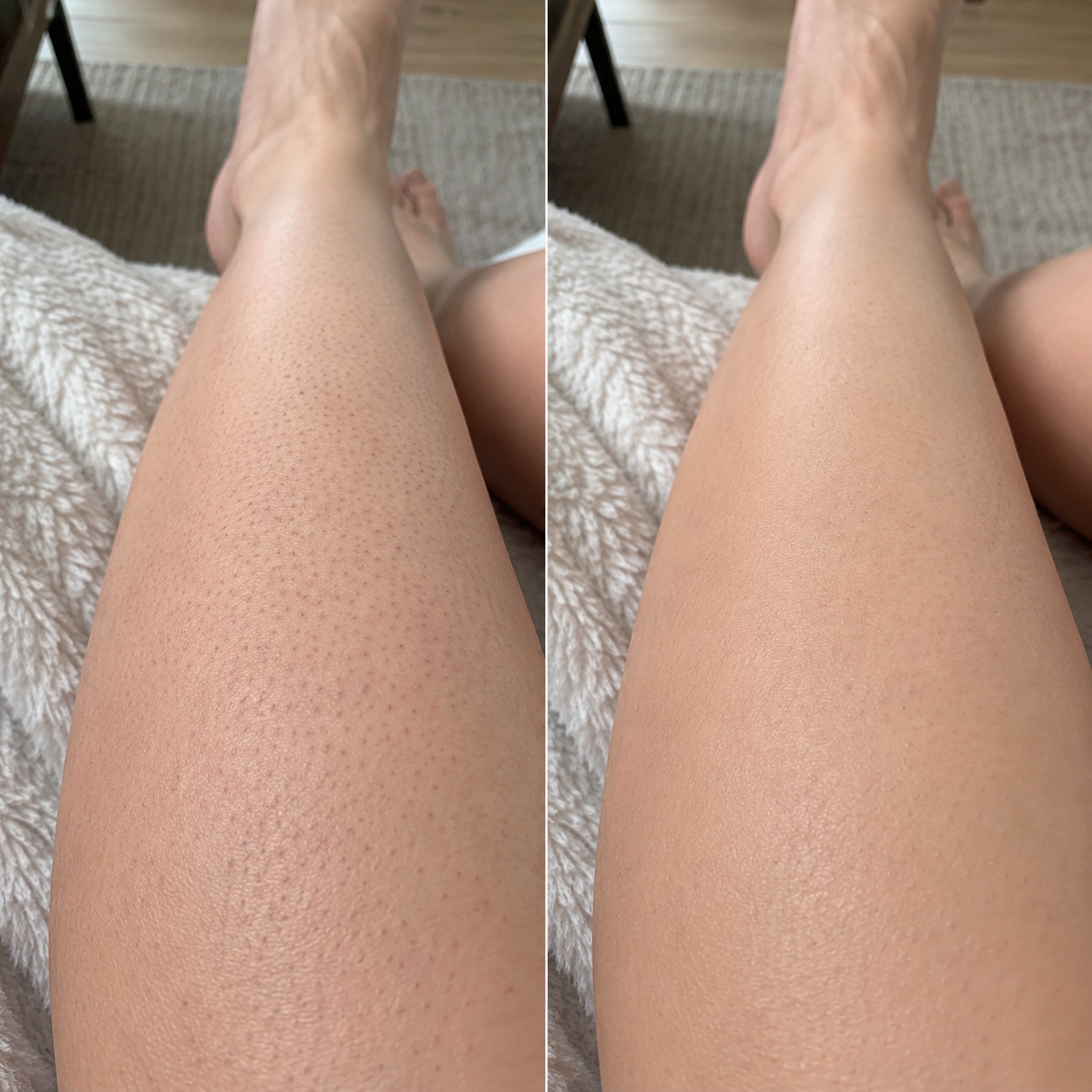 Leg texture before and after exfoliating care